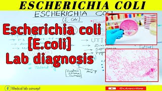 Escherichia coliEcoliLab diagnosisMedical Lab Concept [upl. by Ades847]