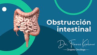 Obstrucción Intestinal  Dr Franco Krakaur Cirujano Oncólogo [upl. by Rekcut]