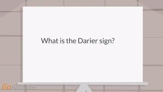 What is the Darier sign [upl. by Kellda]