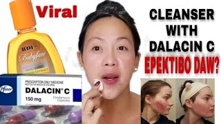 Cleanser with dalacin c [upl. by Aiem]