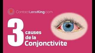 La Conjonctivite de Loeil  3 Causes de Rougeurs Dans les Yeux [upl. by Brena192]