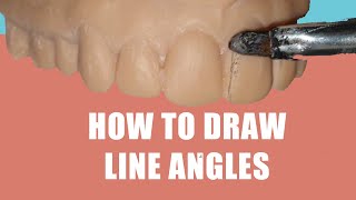 How to Draw Line Angles on Teeth with a Pencil in 2 ways [upl. by Ki334]