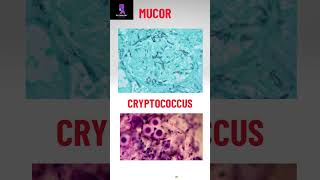 Morphology of some pathogenic fungi pathologyacademy mbbs draditikumar labtechnician [upl. by Aihsemaj420]