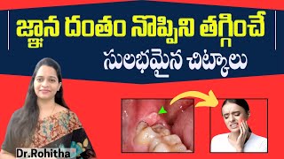 జ్ఞాన దంతం నొప్పికి  Pericoronitis  Causes Symptoms  treatment and Home Remedies in Telugu [upl. by Nuahsad]