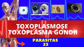 TOXOPLASMOSE TOXOPLASMA GONDII  PARASITOLOGIA  INFECTOLOGIA [upl. by Amlus]