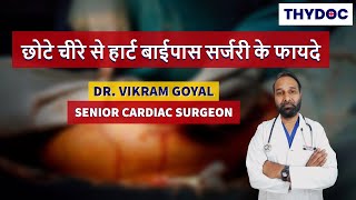 Minimally Invasive Cardiac Bypass Surgery MICS Minimally Invasive Surgery I Dr Vikram Goyal [upl. by Lebanna]