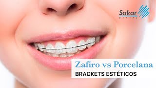 Diferencia entre los brackets de zafiro y de porcelana [upl. by Rahsab]