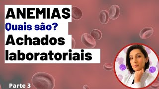 Anemias Achados Laboratoriais Biomedicina  Análises clínicas [upl. by Nylzor246]