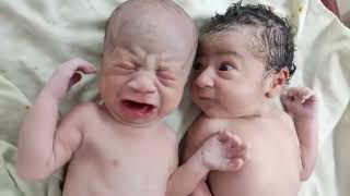 Twins after birth where one is fed up with other one cry  Just Stop It 😂 [upl. by Ruperta426]