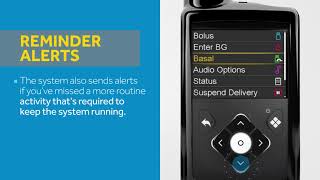 Adjusting Your Alerts –MiniMed 770G System [upl. by Airalav]