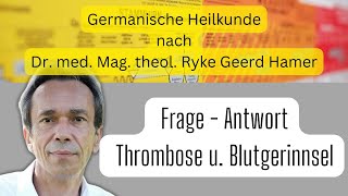 Germanische Heilkunde Frage  Antwort  Thrombose und Blutgerinnsel [upl. by Akenaj]