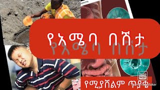 የአሜባ በሽታAmoebiasis 🦠Amoebic Dysentery Lecturing Video Causes Sign and symptomRxDx amp prevention [upl. by Ecadnak]