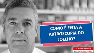 COMO É FEITA A ARTROSCOPIA DO JOELHO [upl. by Amahs]