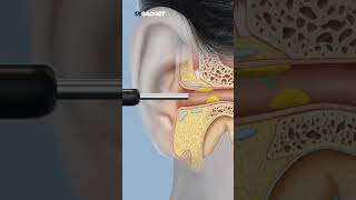 Wireless Visual Ear Pick [upl. by Eartha79]