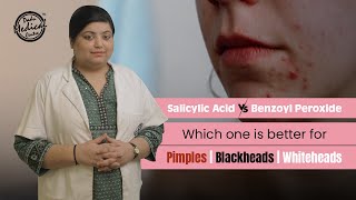 Salicylic Acid vs Benzoyl Peroxide  Get Rid of Pimples Blackheads amp Whiteheads  Dr Nivedita Dadu [upl. by Reger]