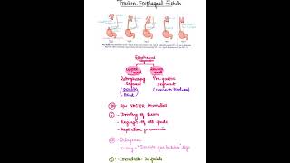 TracheoEsophageal fistula [upl. by Duj]