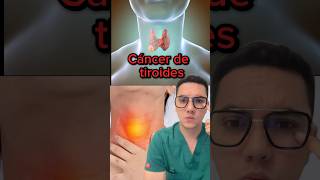 Síntomas de alerta de cáncer de tiroides  Dr William Guerrero medicina shorts [upl. by Odeen294]