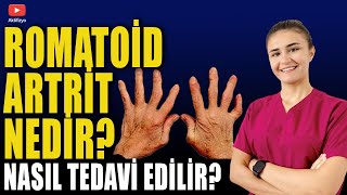 ROMATOİD ARTRİT NEDİR TEDAVİ NASIL YAPILIR [upl. by Bolt]