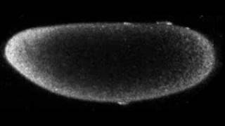 Unfertilized Drosophila egg [upl. by Allana]