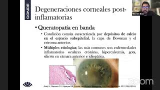 Degeneraciones corneales [upl. by Bertila]