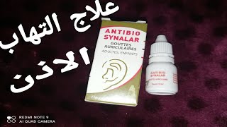 علاج التهاب الأذن فقط بقطرة للصغار والكبار antibio synalar [upl. by Carolynne]