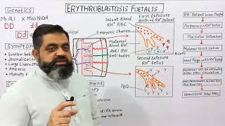 Erythroblastosis Fetalis UrduHindi medium  Prof Masood fuzail Haemolytic Anaemia of Infants [upl. by Kally]