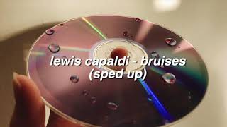 ✰ lewis capaldi  bruises sped up ✰ [upl. by Susann]