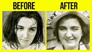 Before And After Photos Of People Who Underwent Lobotomies Are Disturbing [upl. by Rick972]