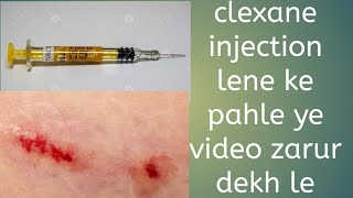 clexane injection in pregnancy [upl. by Goat]