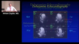 Heart Failure II Evaluating Myocardial Viability – Role of Multimodality Imaging January 24 2017 [upl. by Readus193]