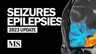 Seizures and Epilepsies 2023 [upl. by Nyltiak]