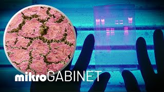 Biofilm – sposób bakterii na uniknięcie antybiotyków  mikroGABINET [upl. by Paige345]