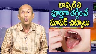 Best Home Remedy For Tonsillitis in Telugu  Tonsillitis Treatment  Telugu Home Tips  Great Health [upl. by Fife374]