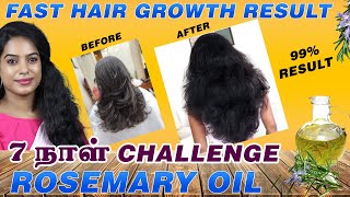 Fast Hair Growth  Rosemary Oil 7 Days Challenge Home Remedy 100 Result  Tamil  Nithya Arunkumar [upl. by Netsirk]