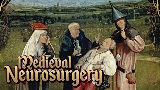 Middle Ages Surgery History of Neurosurgery [upl. by Anerom804]