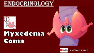 Myxedema Coma  Causes Pathophysiology Treatment [upl. by Rodge]