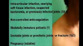 Subacromial Shoulder Joint Injection [upl. by Ynnub]