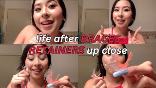 Life After Braces Wearing RETAINERS update  vlog [upl. by Odine897]