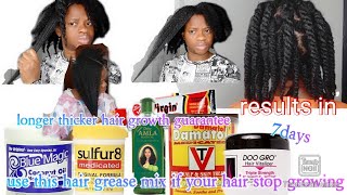 4 longer thicker hair growth faster how 2 use blue magic coconut damatol surful8 hair grease 4 grow [upl. by Ainotahs]