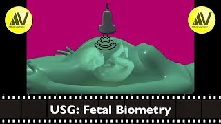 Fetal Biometry Part I [upl. by Ehcsrop]