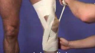 Anterior Cruciate Ligament ACL Taping [upl. by Colinson980]