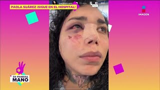 Novio de Paola Suárez se DISCULPA con ella tras fuerte golpiz4  De Primer Mano [upl. by Ellenad]