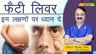 Fatty Liver इन लक्षणों पर ध्यान दे  SYMPTOMS NON ALCOHOLIC FATTY LIVER DISEASE [upl. by Brigitte]