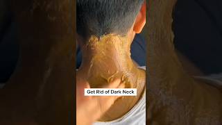 ✅ Neck Cleaning Tips Dark Neck Home Remedy  Tanning Removal Tips 🤔beauty skkncareshortsviral [upl. by Delaryd340]