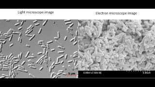 What do bacteria look like under a light vs electron microscope [upl. by Ereveniug]