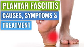 Plantar Fasciitis Causes Symptoms amp Treatment [upl. by Drofniw]