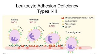 Defects in Leukocyte Function  Acute and Chronic Leukocyte Adhesion Deficiency [upl. by Jarrow]