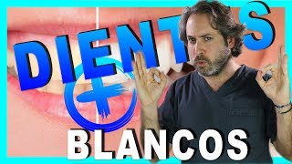 🔥5 MEJORES pastas dentales para BLANQUEAR los dientesComo Blanquear dientes sin DAÑAR EL ESMALTE [upl. by Elden]