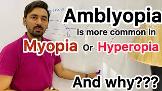 Amblyopia more common in hyperopia or Myopia and Why [upl. by Edasalof]