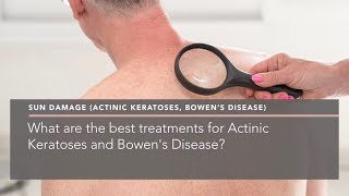 What are the best treatments for Actinic Keratoses and Bowens Disease [upl. by Hayalat]